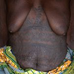 The ancient tradition of bodily tattoos in Holi women was stopped by the Beninese government and Christian missionaries in the 1970s. Now only a handful of older Holi women have tattooing on their bodies