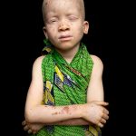 Across Africa albinism is dealt with by different people in different ways. In Benin albino children are quite widely accepted and they happily play with others without an issue. Portrait of Isaac