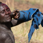 An injured Suri warrior during a stick fight (image by Inger Vandyke)