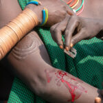 Close up of the scarification practice in Suri people (image by Inger Vandyke)
