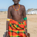 A Dassanech elder with traditional blood-letting scarification (image by Inger Vandyke)