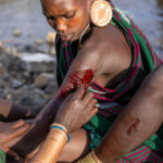 A close-up of the scarification practice in Suri people (image by Ingrid Koedood)