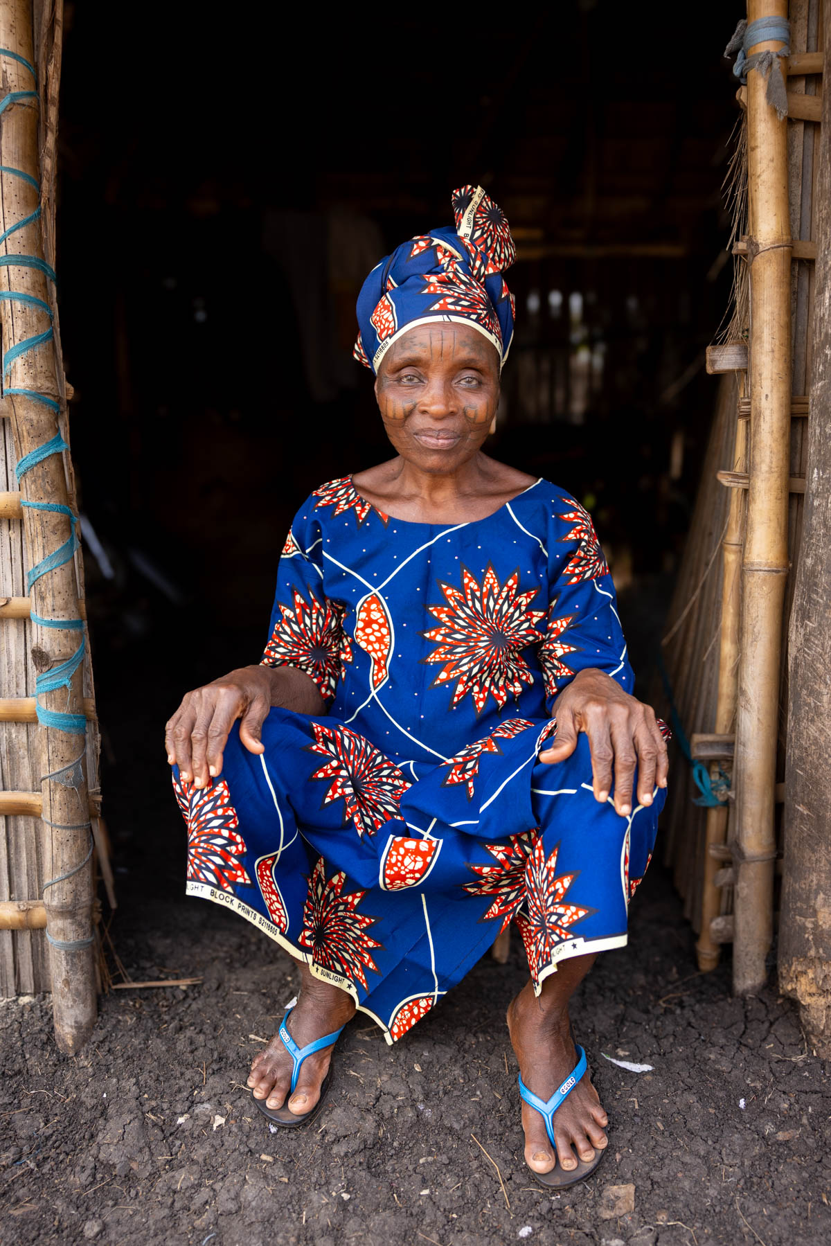 Among the Holi tribe in Benin, traditional scarification appears not only on the face but also on the body, including the stomach. These are marks of identity and heritage (image by Ingrid Koedood)