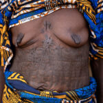 Traditional Holi scarification. Markings on the body as symbols of identity and heritage (image by Ingrid Koedood)