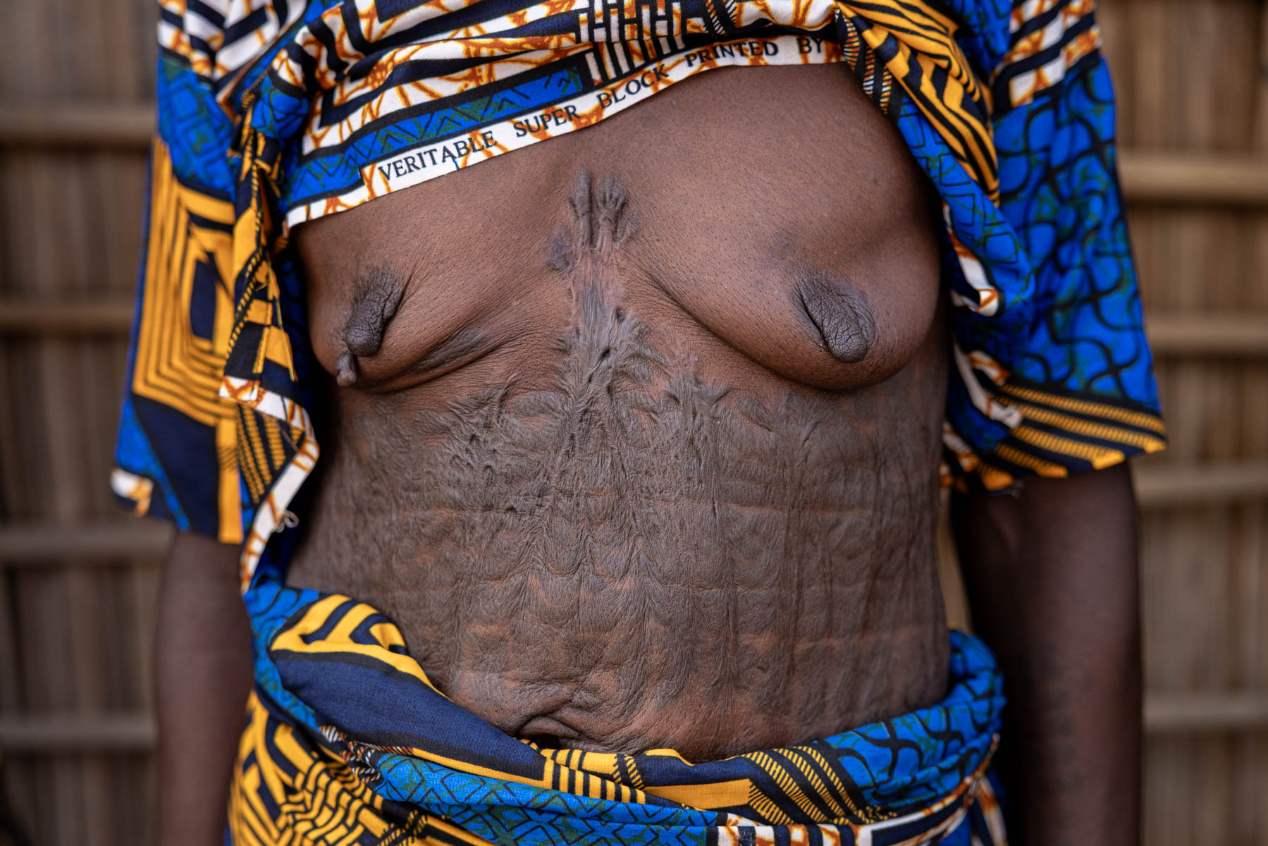Traditional Holi scarification. Markings on the body as symbols of identity and heritage (image by Ingrid Koedood)