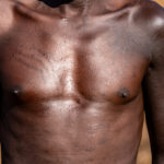 Pokot scarification (image by Inger Vandyke)