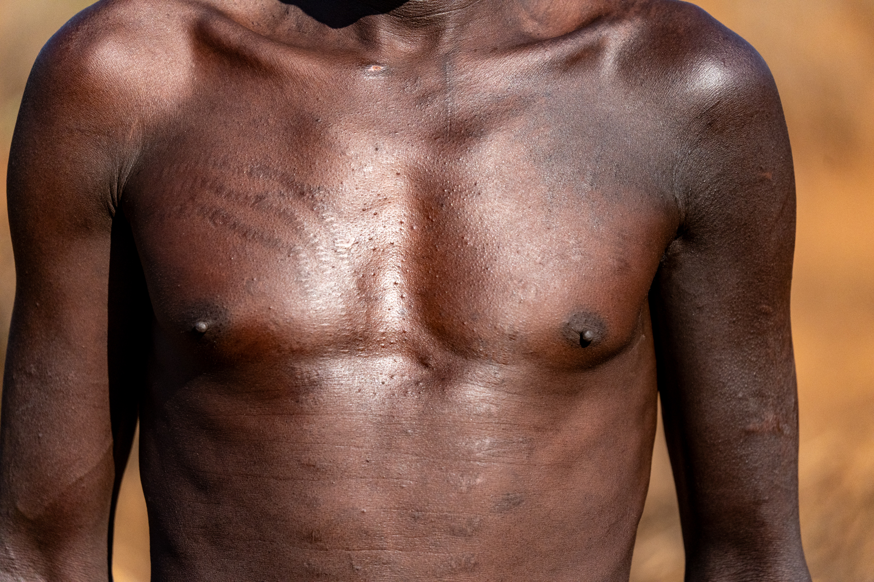 Pokot scarification (image by Inger Vandyke)